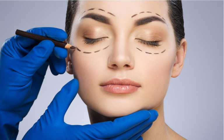 Combined Upper and Lower Eyelid Blepharoplasty